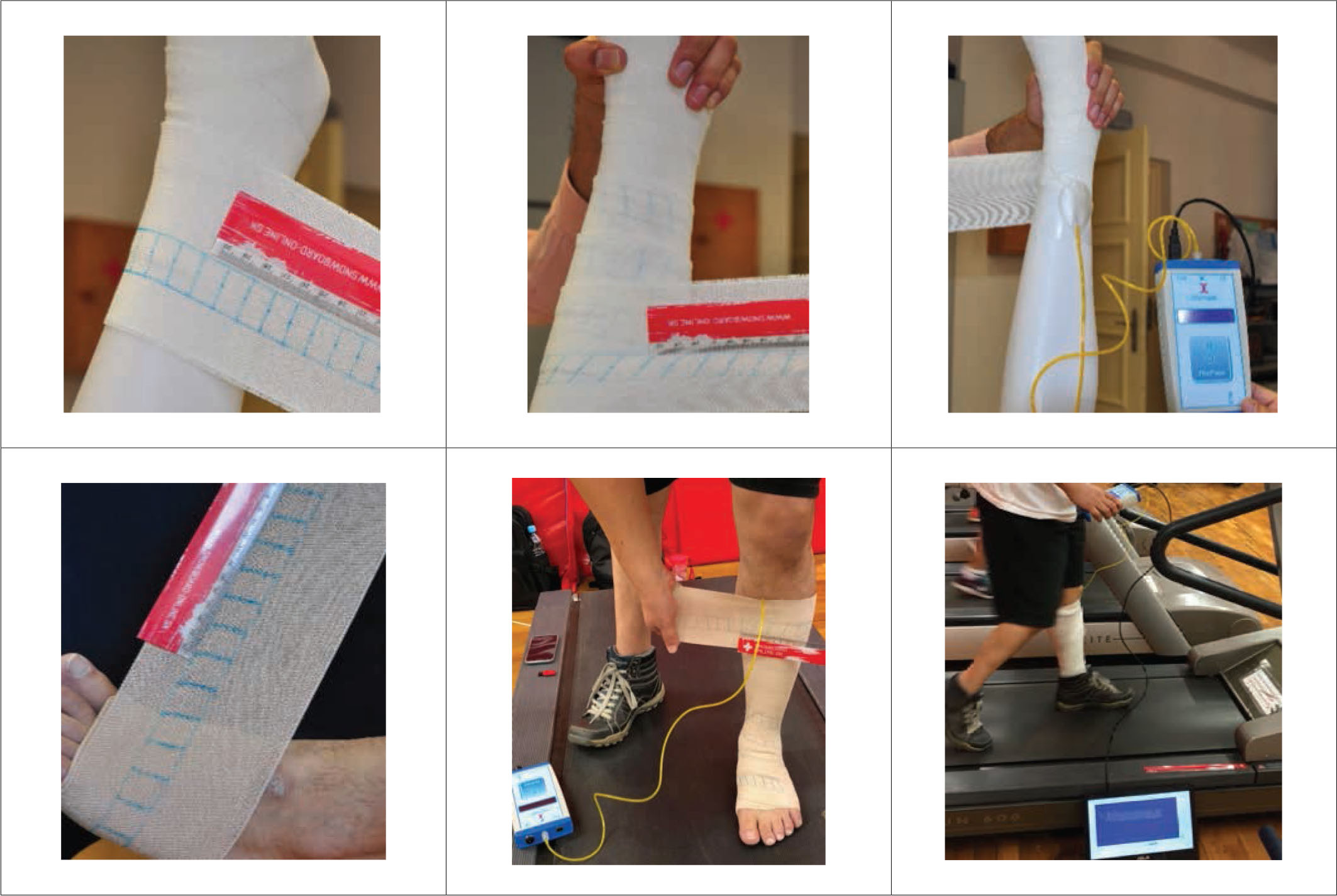 Figure 2 Application of CB on mannequin and real leg. CB, compression bandage