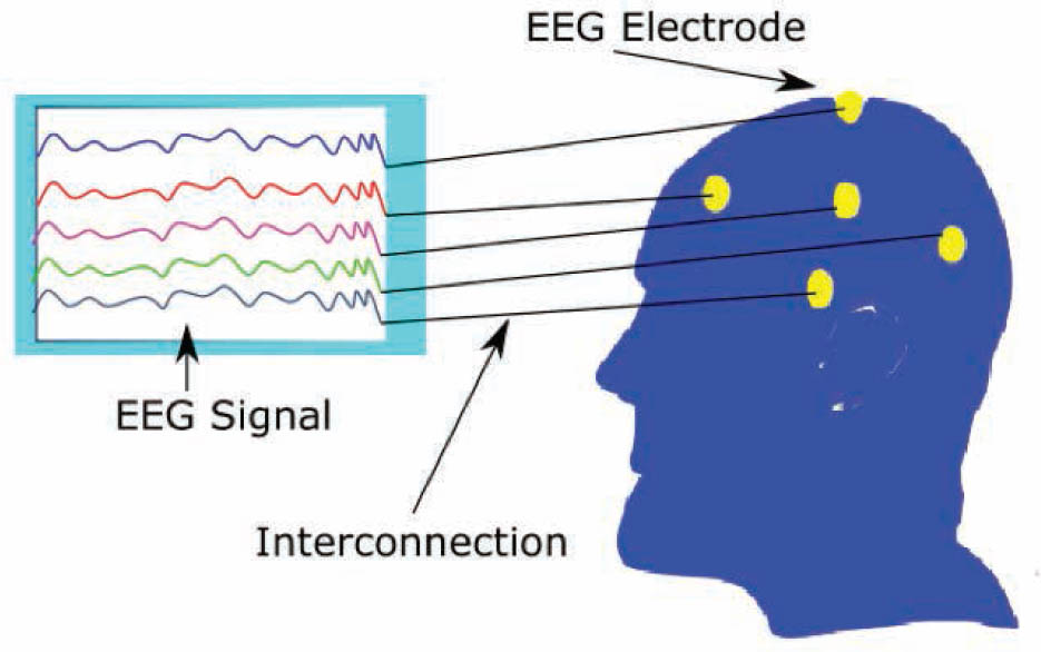 Figure 2 Brain activity measurement using EEG electrodes.