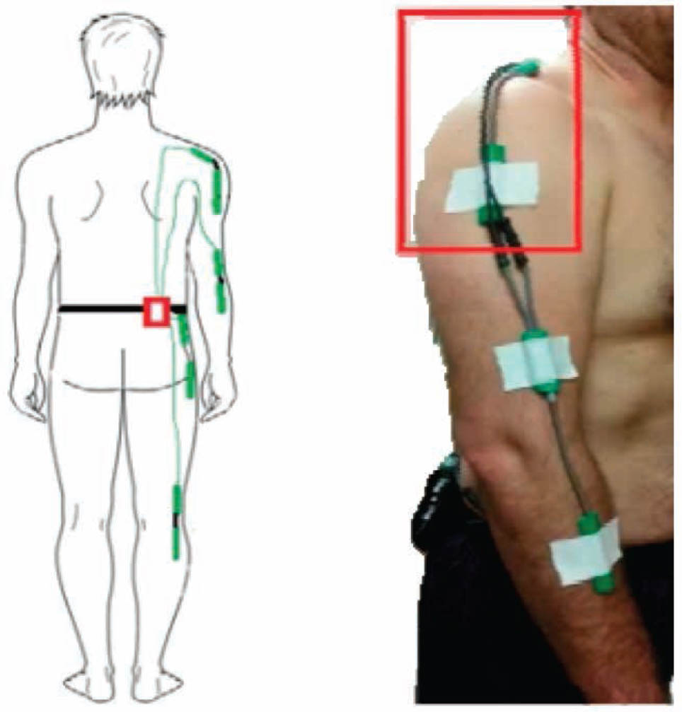 Figure 3 Distribution of the electrogoniometers on the body of the subjects (copied from Ciesielska-wróbel et al. [83]).