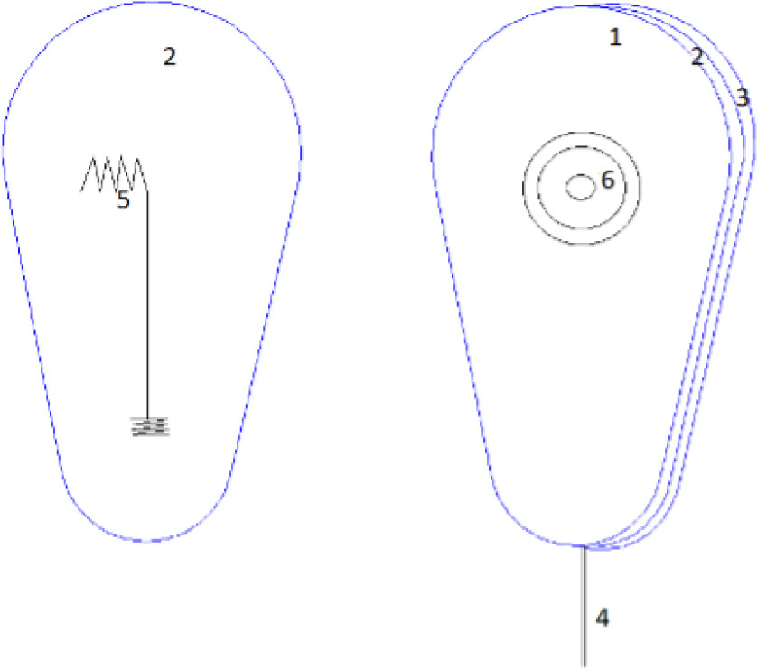 Figure 4 The construction of the textile electrodes: (1) first cotton layer, (2) second (middle) cotton layer, (3) third cotton layer, (4) carbon wires, (5) electrical circuit sewn with Shieldex yarn, and (6) gel electrode.