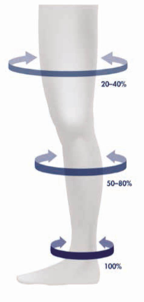 Figure 1. Mechanism of action of compression socks [5]