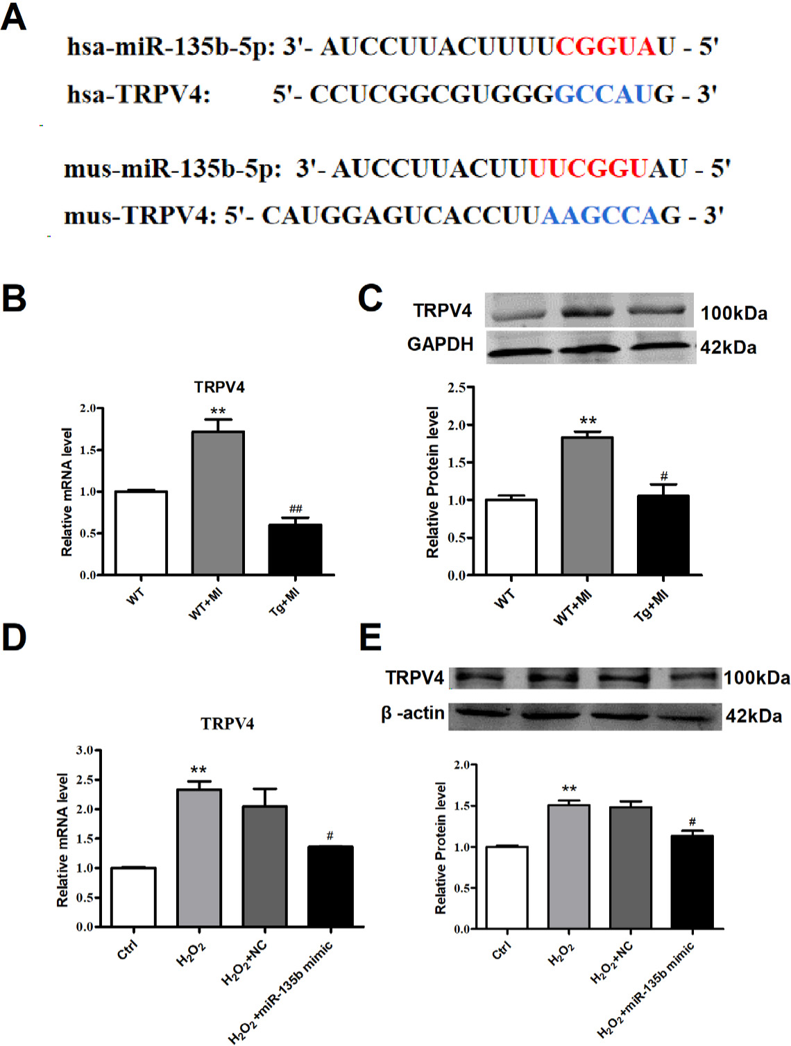 Fig. 6 miR-135b represses the expression of TRPV4 both in vivo and in vitro(A) The predicted binding site for miR-135b in TRPV4 sequences of humans and mice. (B) The mRNA and (C) protein expression of TRPV4 in vivo. (D) The mRNA and (E) protein expression of TRPV4 in vitro. n = 3; **P < 0.01 vs. WT or Ctrl, #P < 0.05, ##P < 0.01 vs. WT+MI or H2O2. The data are presented as mean ± SD.