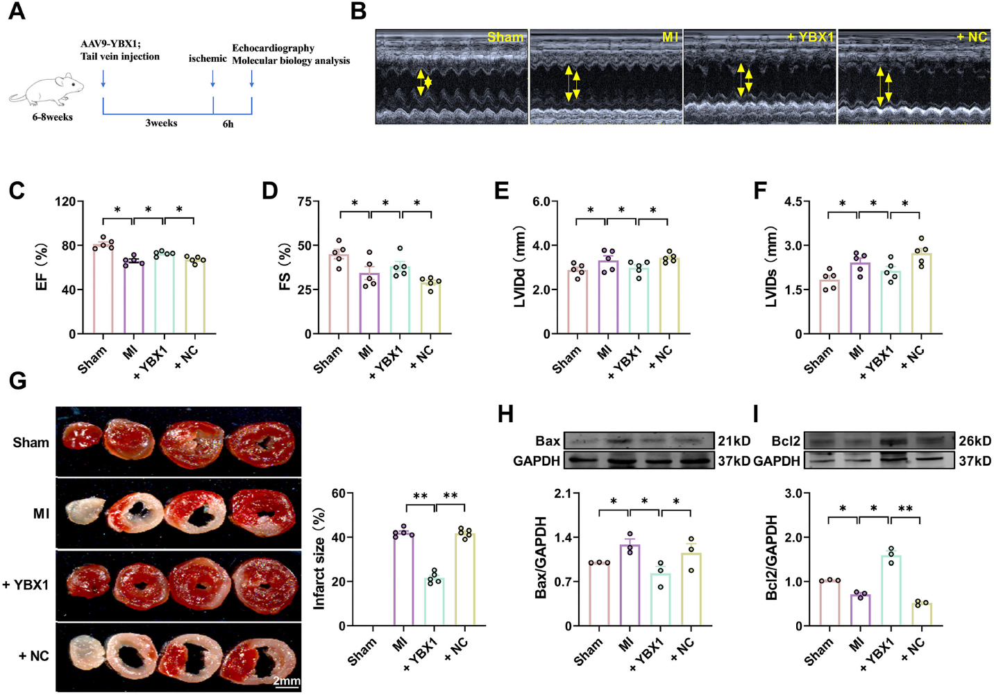 Fig. 2 
Overexpression of YBX1 improves cardiac function in myocardial infarction (MI) mice. YBX1 was overexpressed by an AAV9 vector engineered to contain the full-length YBX1 gene in MI mice. (A) Experimental procedure. (B) Echocardiographic analysis of left ventricular dimensions and cardiac function in mice. (C) EF: ejection fraction (D) FS: fractional shortening of left ventricular diameter. (E) LVIDs: systolic left ventricular internal diameters. (F) LVIDd: diastolic left ventricular internal diameters. *P < 0.05, N = 5. (H) TTC staining. **P < 0.01, N = 5 duplicates/group. (H, I) Representative bands and statistical data on Bax and Bcl-2 expression, as determined by Western blot analysis. *P < 0.05, **P < 0.01, N = 3 duplicates/group.
