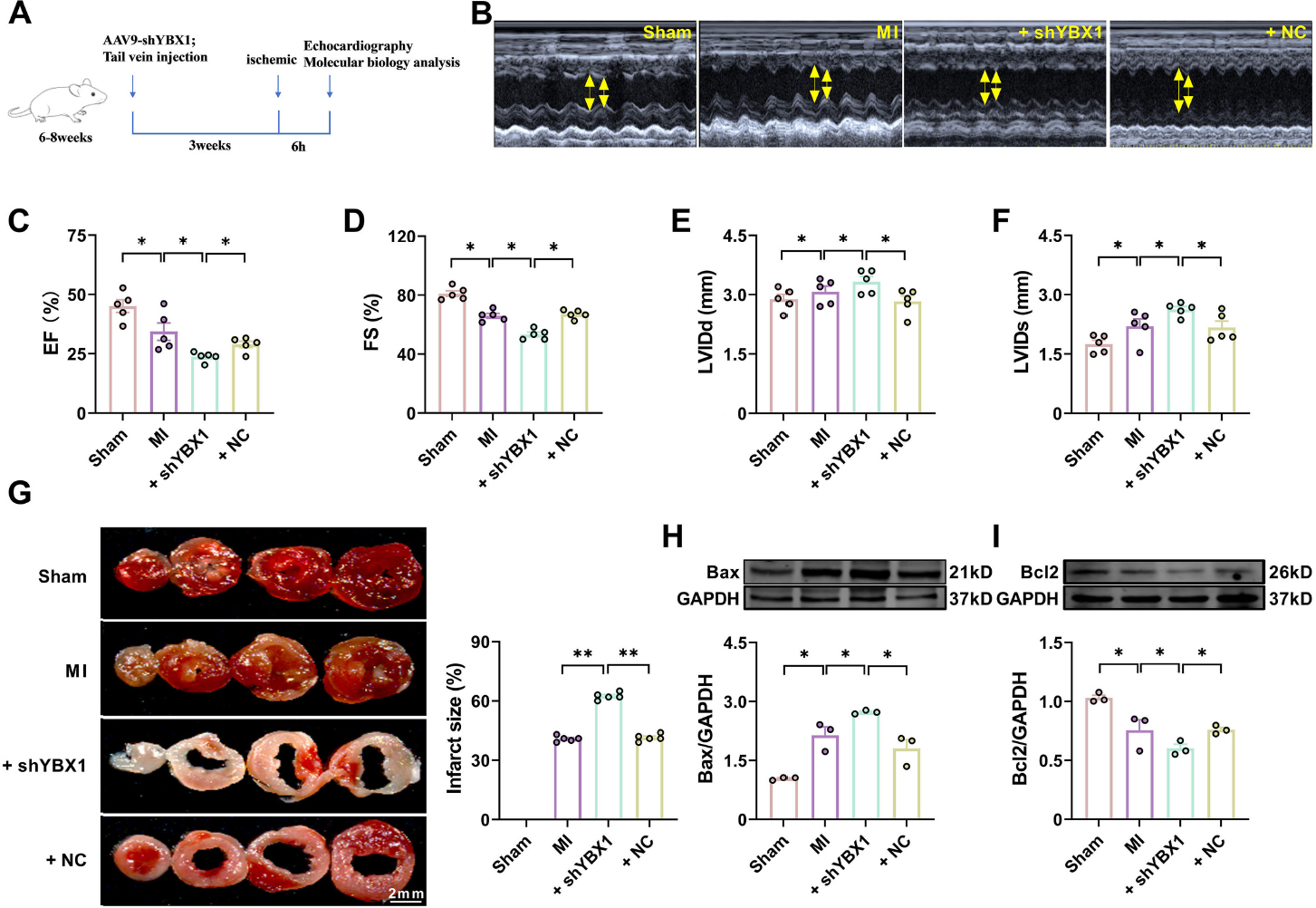 Fig. 3 
Knockdown YBX1 aggravates cardiac dysfunction in myocardial infarction (MI) mice. YBX1 was knocked down via an AAV9 vector carrying a YBX1-specific shRNA in mice. (A) Experimental procedure. (B) Echocardiographic analysis of left ventricular dimensions and cardiac function in mice. (C) EF: ejection fraction (D) FS: fractional shortening of left ventricular diameter. (F) LVIDs: systolic left ventricular internal diameters. (F) LVIDd: diastolic left ventricular internal diameters. *P < 0.05, N = 5. (G) Representative images of TTC staining. **P < 0.01, N = 5 duplicates/group. (H, I) Representative bands and statistical data on Bax and Bcl-2 expression, as determined by Western blot analysis. *P < 0.05, N = 3 duplicates/group.
