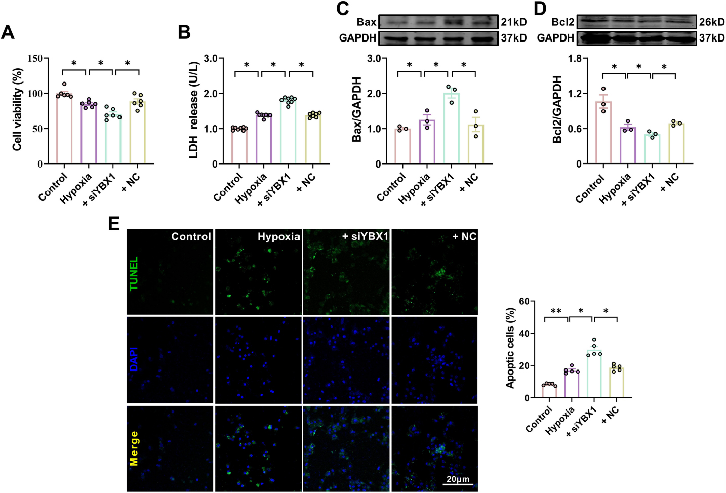 Fig. 6 
Silencing YBX1 aggravates hypoxia-induced cardiomyocyte apoptosis. (A) Viability of cardiomyocytes. *P < 0.05, N = 6 duplicates/group. (B) LDH release. *P < 0.05, N = 8 duplicates/group. (C, D) Representative Western blot bands and statistical data on Bax and Bcl-2 expression in NMCMs. *P < 0.05, N = 3 duplicates/group. (E) Typical images of TUNEL staining of cardiomyocytes. Scale bar: 20 pm; *P < 0.05, **P < 0.01, N = 5 duplicates/group. The data are presented as mean ± SEM.
