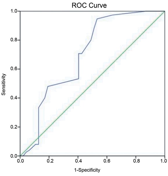 Figure 3 Direct bilirubin with a threshold of < 0.14 can be used as a diagnostic test (P = 0,00) for Behçet disease with 70% sensitivity, 68% specificity (area under the curve = 0,69; 95% confidence interval:0.59–0.80). Diagonal segments are produced by ties