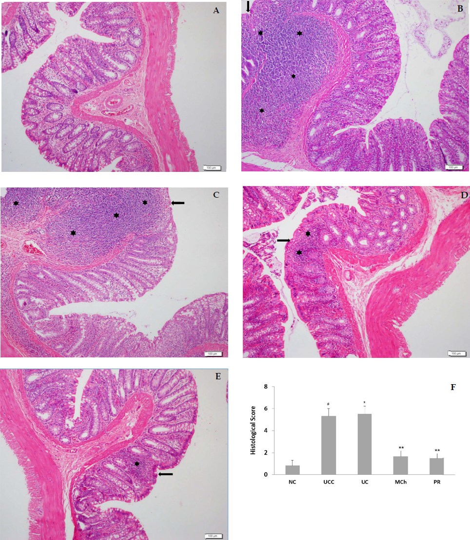 Figure 1 Histopathological images of colon tissues stained with H&E. (A) The appearance of normal colonic mucosa in the normal control group. (B and C) Inflamed ulcerative colitis mucosa in colitis control and colitis groups, associated with mucosal layer destruction, crypt damage and intense inflammatory cell infiltration in the mucosa and submucosa. Colitis tissue treated with (D) MCh (4 g/kg/day) and (E) PR (2 mg/kg/day) showing improved histopathological signs of colon damage including the decrease of infiltration areas in the lamina propria layer of mucosa and loss of crypts seen less than colitis group. ( : infiltration areas, : loss of crypts). (F) Histopathological analysis showed tissue degradation. #P < 0.001 vs. the control group; *P < 0.01, **P < 0.001 vs. the model group.