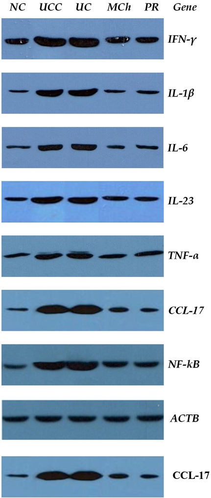 Figure 2 Quantification of proteins in rat colon tissues from various groups by western blot analysis. Rats were treated and proteins were extracted as described in Materials and Methods section. The proteins were separated by SDS-PAGE and western blot analysis was performed as described. Each lane contained 100 μg protein. Proteins were detected using chemiluminescent substrate and bands were visualized and recorded using a DNR Light IS Pro Image Analysis System.