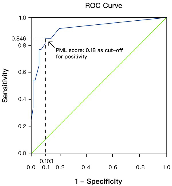 Figure 5 ROC curve for promyelocytic leukemia (PML) score. AUC: 0.917 (95%CI: 0.84–0.99). Sensitivity and specificity for the diagnosis of primary biliary cholangitis (PBC) at cut-off point 0.18: 84.6% and 89.7%, respectively.