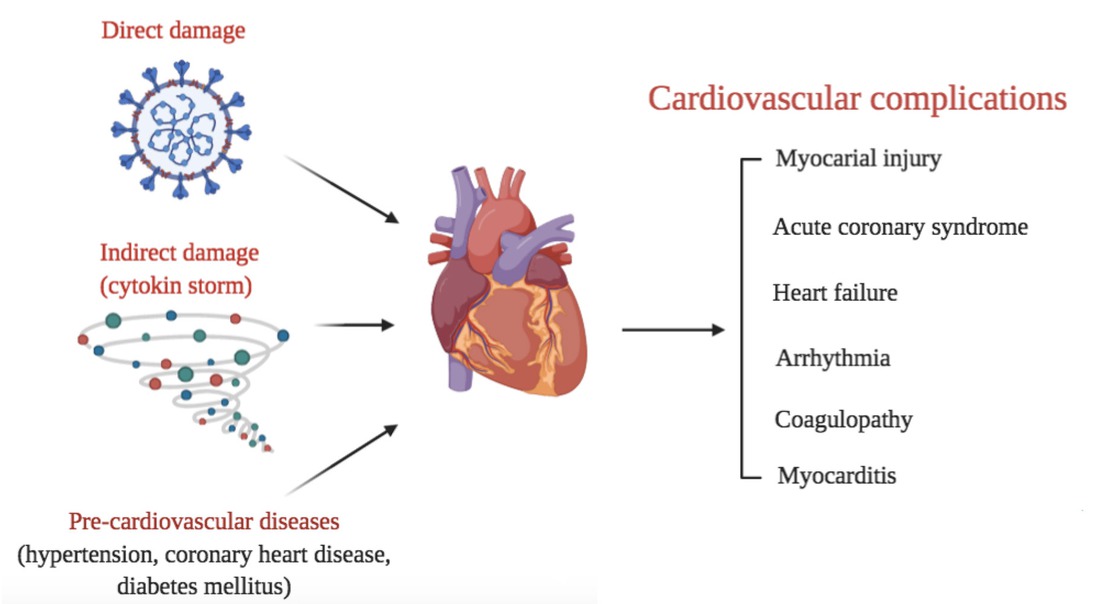Figure 1 Cardiovascular involvements during the infection of SARS-CoV-2 caused by direct damage, indirect damage, and aggravated by the existence of pre-cardiovascular diseases