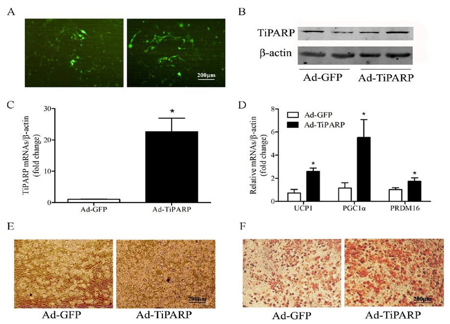 Figure 3 Overexpression of TiPARP accelerates adipogenic differentiation of brown preadipocytes. Primary brown adipocytes were isolated from neonatal C57BL/6J mice and transfected with 106 plaque forming unit (PFU) TiPARP adenoviruses for 48 h and cultured for differentiation at the same time, while controls used GFP adenoviruses. (A) GFP expression was observed in brown adipocytes under fluorescence microscopy. (B) Proteins were extracted after 6 days of differentiation, and Western blotting of TiPARP was performed. Total RNA was extracted after 6 days of differentiation. Real-time PCR was performed to evaluate the expression of TiPARP (C) and brown adipocyte marker genes (D). Levels of mRNA expression were normalized to β-actin and expressed as mean ± SEM (n = 4). (E) Brown adipocyte morphology was observed by light microscope after adenovirus transfection. (F) Oil red O staining was performed to demonstrate the lipid droplets after adenovirus transfection. *P < 0.05 relative to Ad-GFP control. TiPARP: TCDD-inducible poly (ADP-ribose) polymerase; GFP: green fluorescent protein; Ad-TiPARP: TiPARP-expressed adenovirus; Ad-GFP: GFP-expressed adenovirus.