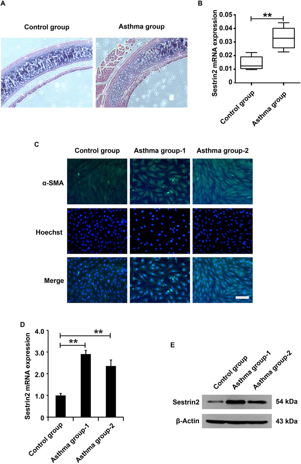 Figure 1 Upregulation of Sestrin2 in the airway of the asthma model. (A) HE assay analysis of the airway in an asthma rat model. (B) qPCR analysis of Sestrin2 expression in an asthma rat model. Ten rats in each group. (C) Immunofluorescence assay analysis of α-SMA expression in ASMCs. (D and E) qPCR and western blotting analysis of Sestrin2 expression in ASMCs. qPCR analysis was repeated three times. “Asthma group 1” represents the ASMCs isolated and cultured from the tracheal smooth muscle tissue of an asthmatic rat, while “Asthma group 2” represents the ASMCs isolated from another asthmatic rat. β-Actin served as an internal reference. **P < 0.01.