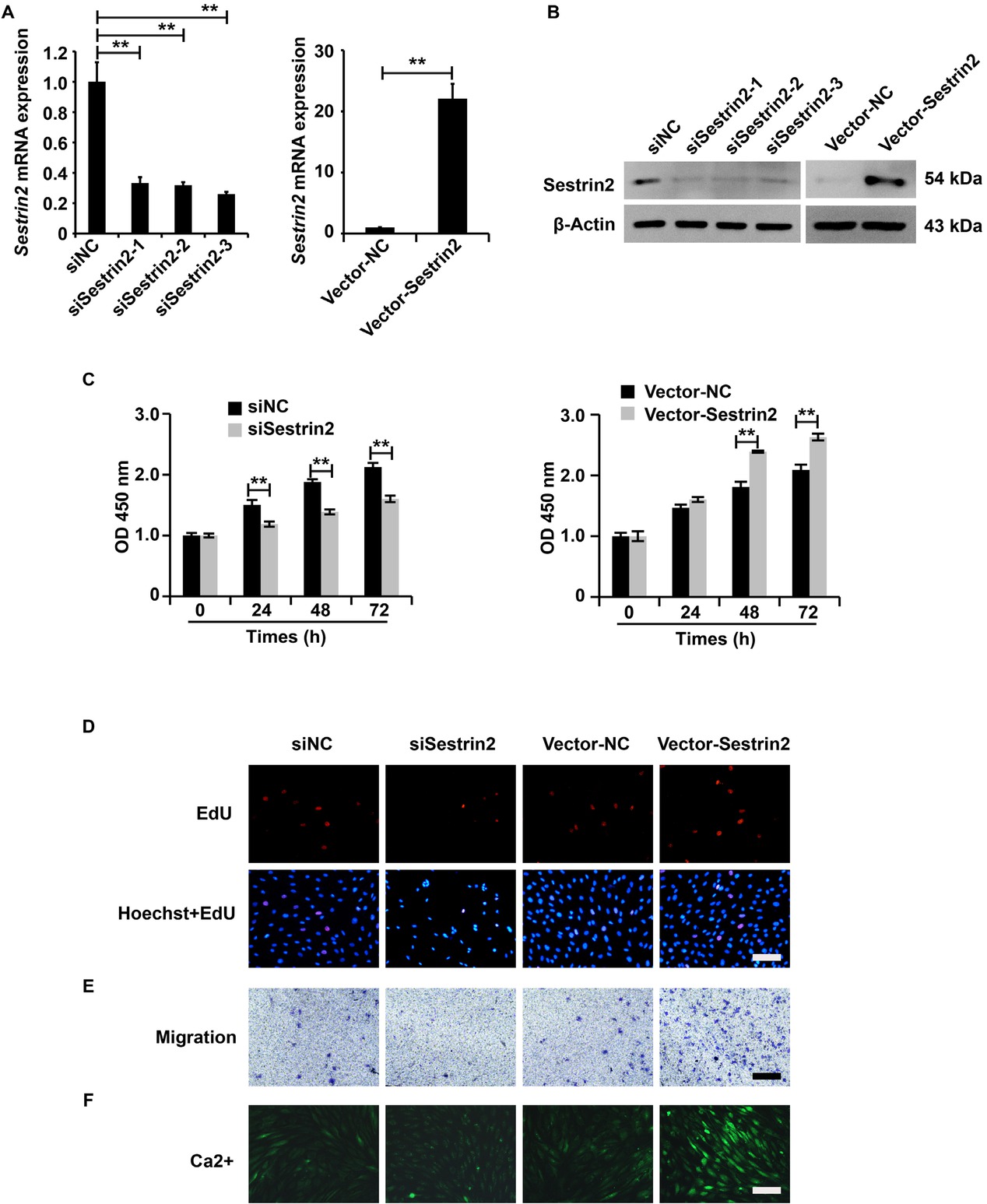 Figure 2 Sestrin2 promoted the cellular function of ASMCs from the asthma group. (A) qPCR analysis of Sestrin2 expression. qPCR analysis was repeated three times. (B) Western blotting analysis of Sestrin2 expression. (C) CCK-8 assay analysis of cell viability. qPCR analysis was repeated three times. (D) EdU assay analysis of cell proliferation. (E) Transwell assay analysis of cell migration. (F) Fluo-3AM assay analysis of calcium flow. β-Actin served as an internal reference. qPCR and CCK-8 analysis were repeated three times. **P < 0.01.