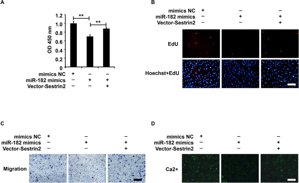 Figure 4 miR-182/Sestrin2 pathway affected the cellular function of ASMCs from the asthma group. (A) CCK-8 assay analysis of cell viability. (B) EdU assay analysis of cell proliferation. (C) Transwell assay analysis of cell migration. (D) Fluo-3AM assay analysis of calcium flow. CCK-8 analysis was repeated three times. **P < 0.01.