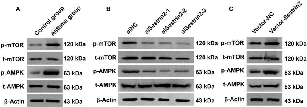 Figure 5 Sestrin2 activated the AMPK/mTOR signaling pathway in ASMCs from the asthma group. (A) Western blotting analysis of the AMPK/mTOR pathway in asthmatic and control ASMCs. (B and C) Western blotting analysis of the AMPK/mTOR pathway in ASMCs with altered Sestrin2 expression.