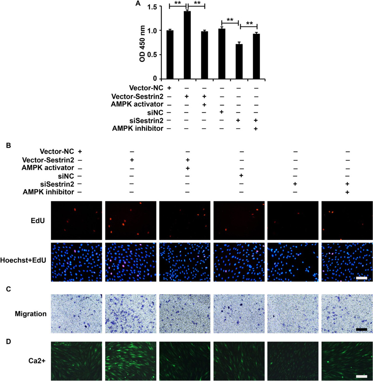 Figure 6 Modulation of the AMPK/mTOR signaling pathway affected the role of Sestrin2 in ASMCs from the asthma group. (A) CCK-8 assay analysis of cell viability. (B) EdU assay analysis of cell proliferation. (C) Transwell assay analysis of cell migration. (D) Fluo-3AM assay analysis of calcium flow. β-Actin served as an internal reference. CCK-8 analysis was repeated three times. **P < 0.01.