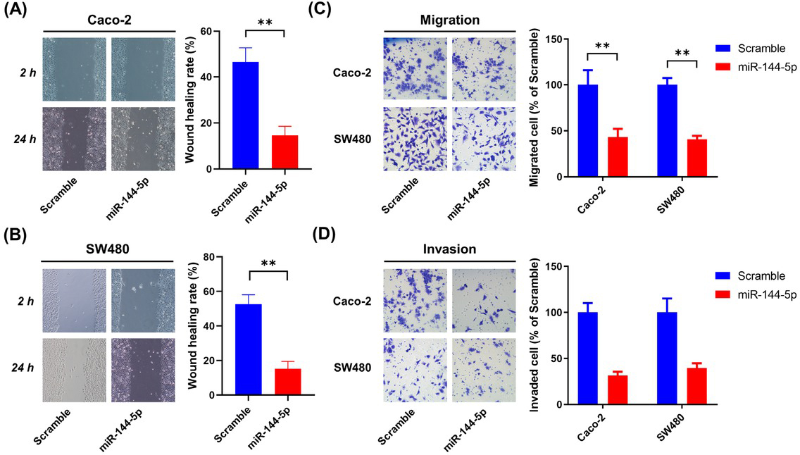Figure 6 miR-144-5p restrained the migration and invasion of CRC cells. Caco-2 and SW480 cells were transfected with either miR-144-5p mimics or scrambled control for 48 h. (A and B) Wound healing was detected by cell scratch tests. (C) Cell migration was assessed by the Transwell migration assay. (D) Cell invasion was determined by the Transwell Matrigel invasion assay. Data are representative images or expressed as the mean±standard deviation. **P < 0.01. CRC: colorectal cancer