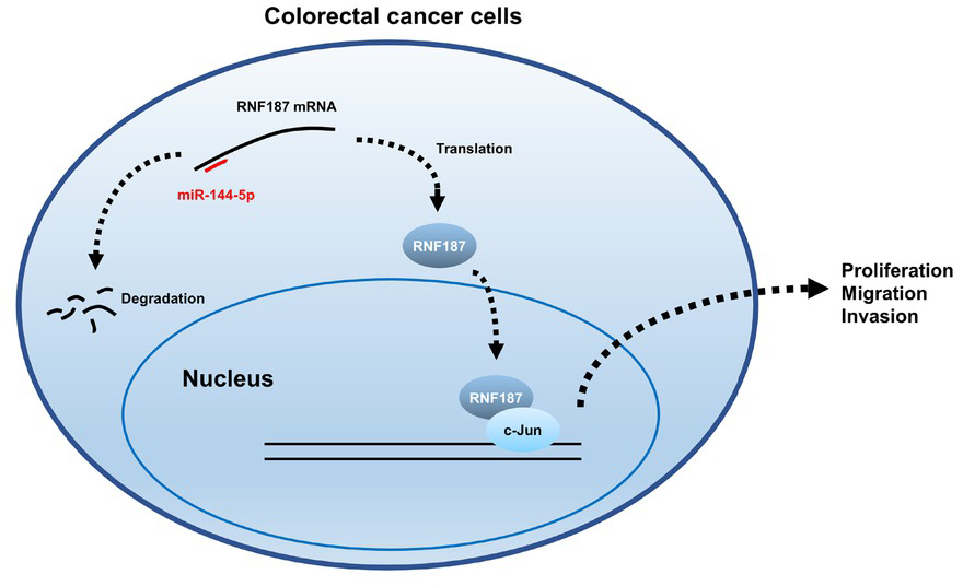 Figure 8 Schematic representation of dysregulation of miR-144-5p/RNF187 axis. miR-144-5p targets RNF187 mRNA for degradation, thus reducing RNF187 protein levels. In CRC cells, the downregulated expression of miR-144-5p leads to an increased level of RNF187, which interacts with c-Jun to regulate the expression of cancer-related genes involved in proliferation, invasion and migration. CRC: colorectal cancer.