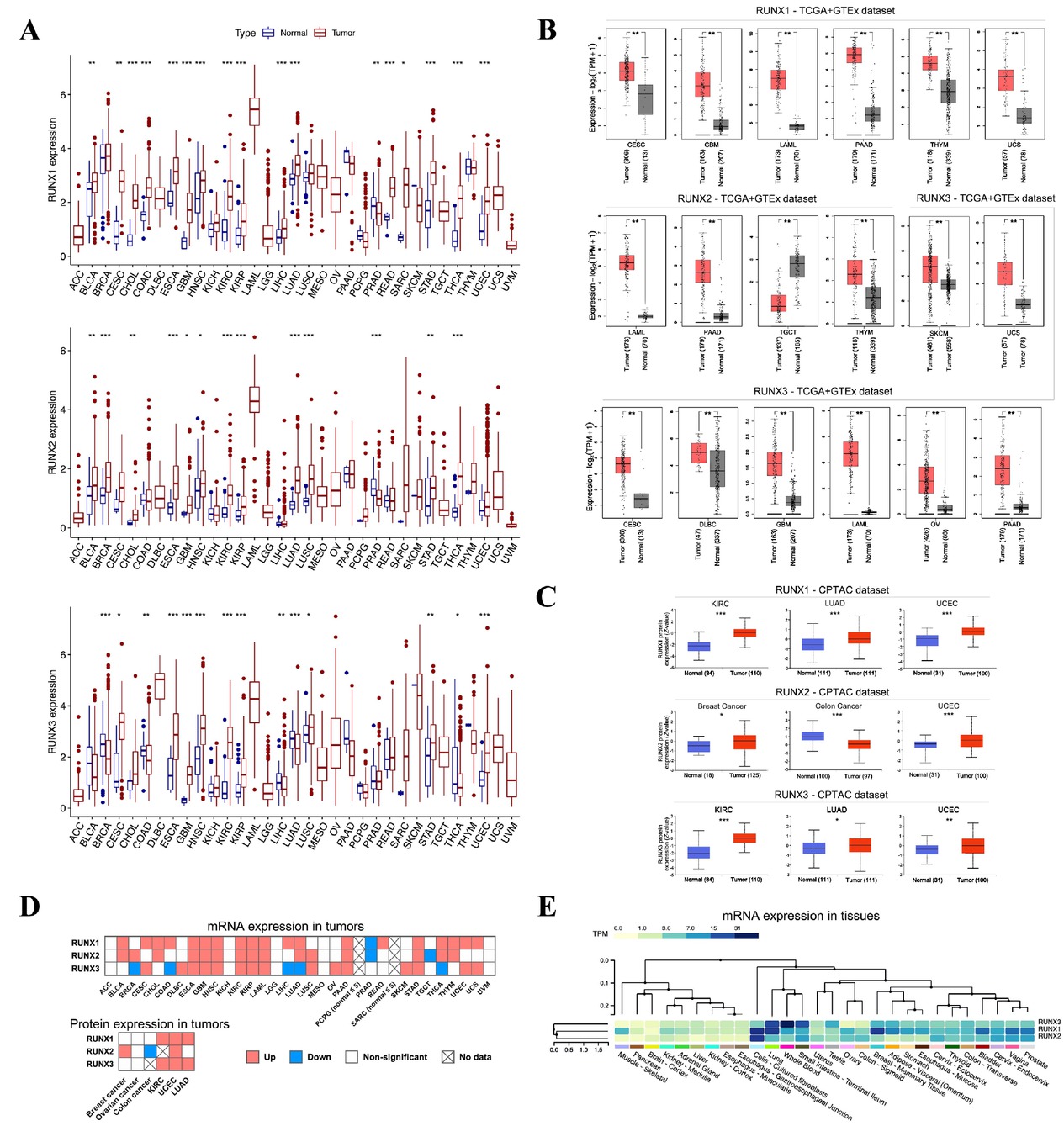 Figure 1 Pan-cancer expression of RUNX genes. (A) Comparison of RUNX mRNA expression in cancer and adjacent normal tissues. (B) Comparison of RUNX expression data from TCGA and GTEx databases in cancers that lacked or had fewer normal tissues. (C) Total RUNX protein expression in certain cancers. (D) The pan-cancer landscape of RUNX expression at mRNA and protein levels. (E) Heatmap of RUNX gene expression in various tissues. *P < 0.05, **P < 0.01, and ***P < 0.001. TCGA: The Cancer Genome Atlas; GTEx: genotype-tissue expression; BLCA: bladder urothelial carcinoma; BRCA: breast carcinoma; CESC: cervical squamous cell carcinoma and endocervical adenocarcinoma; COAD: colon adenocarcinoma; DLBC: lymphoid neoplasm diffuse large B-cell lymphoma; ESCA: esophageal carcinoma; GBM: glioblastoma multiforme; HNSC: head and neck squamous cell carcinoma; KICH: kidney chromophobe; KIRC: kidney renal clear cell carcinoma; KIRP: kidney renal papillary cell carcinoma; LAML: acute myeloid leukemia; LGG: lower-grade glioma; LIHC: liver hepatocellular carcinoma; LUAD: lung adenocarcinoma; LUSC: lung squamous cell carcinoma; PAAD: pancreatic adenocarcinoma; PRAD: prostate adenocarcinoma; SKCM: skin cutaneous melanoma; STAD: stomach adenocarcinoma; TGCT: testicular germ cell tumors; THCA: thyroid carcinoma; THYM: thymoma; UCEC: uterine corpus endometrial carcinoma; UVM: uveal melanoma.