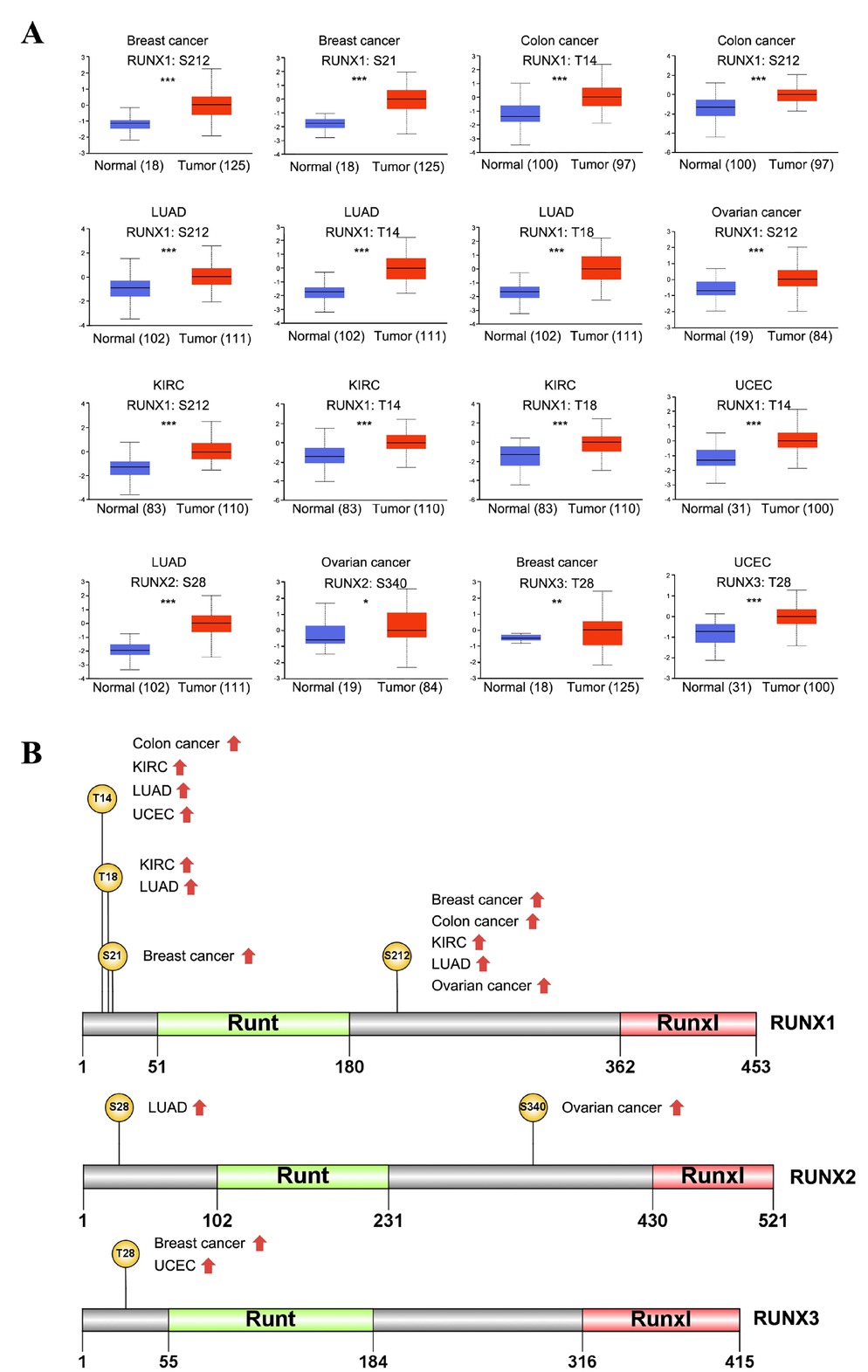 Figure 2 Phosphorylation analysis of RUNX proteins in different tumors. (A) Box plots show the phosphorylation sites in RUNX proteins that are positively associated with different cancers. (B) The RUNX protein schematic shows phosphoprotein sites with positive results. *P < 0.05, **P < 0.01, and ***P < 0.001. KIRC: kidney renal clear cell carcinoma; LUAD: lung adenocarcinoma; UCEC: uterine corpus endometrial carcinoma.