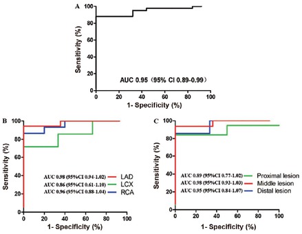 Figure 5 Diagnostic performance of FFRCT-angio. (A) Diagnostic performance of per-vessel level. (B) Diagnostic performance of different target vessels. (C) Diagnostic performance of different segments. AUC: area under receiver operating characteristics curve; CI: confidence interval; LAD: left anterior descending; LC: left circumflex artery; RCA: right coronary artery.
