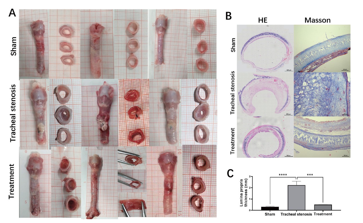 Figure 4 Representative morphologic evaluation of the trachea in different groups. (A) Morphologic gross manifestation of the trachea in different groups. (B) Histologic evaluation of the trachea in different groups by HE staining and Masson staining. (C) Comparison of LP thickness in different groups in HE staining. Values are expressed as the mean ± SEM (n = 5 rabbits/group). ***P < 0.001 and ****P < 0.0001. HE: hematoxylin and eosin; LP: lamina propria; SEM: standard error of the mean.