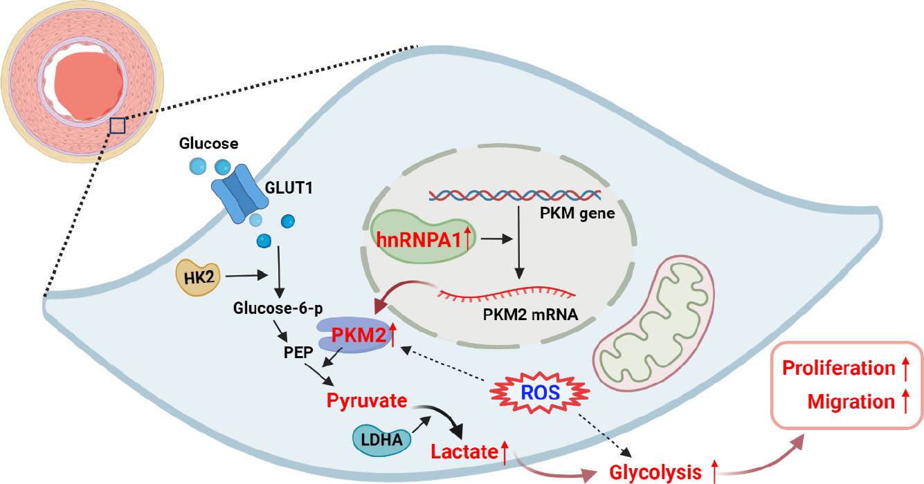 Figure 7 Schematic diagram showing the mechanisms via which the hnRNPA1/PKM2 signaling axis regulates glycolysis in PEA-PASMCs. An increased expression of hnRNPA1 produced more PKM2, which promoted cellular glycolysis, increasing proliferative and migratory activities in PEA-PASMCs. Increased intracellular ROS generation promoted glycolysis in PEA-PASMC. GLUT1: glucose transporter 1; HK2: hexokinase 2; PEP: phosphoenolpyruvate; LDHA: lactate dehydrogenase A; ROS: reactive oxygen species. This figure is created with BioRender.com.