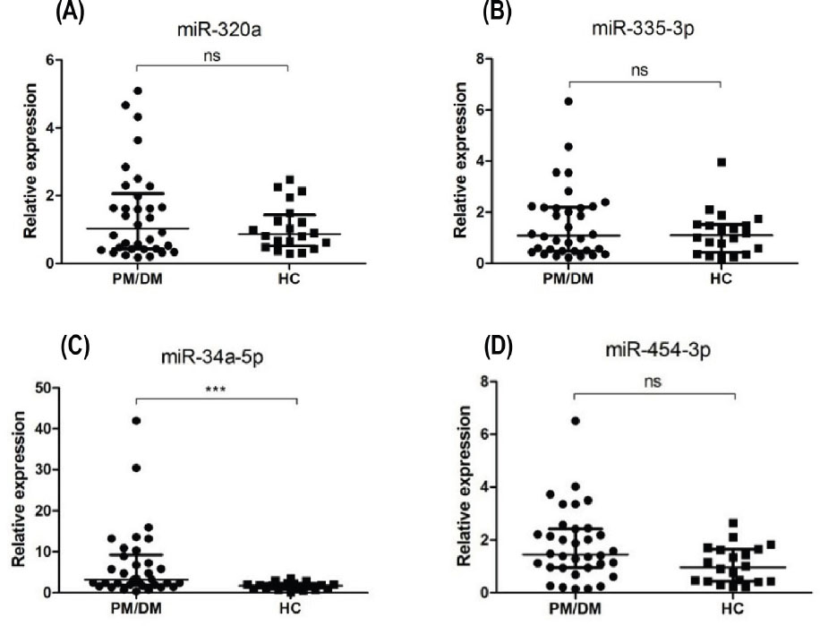 Figure 2 Differential expression of 4 miRNAs in the peripheral blood mononuclear cells from PM/DM patients (n = 34) and healthy controls (n = 20). (A-D) qRT-PCR results for miR-320a, miR-335-3p, miR-34a-5p, miR454-3p levels, respectively. Mean miR-34a-5p level in PM/DM patients was significantly higher than that in HCs. The relative expression levels were normalized to the expression of U6. *** P < 0.005; ns: no significance. HCs: healthy controls; PM: polymyositis; DM: dermatomyositis.