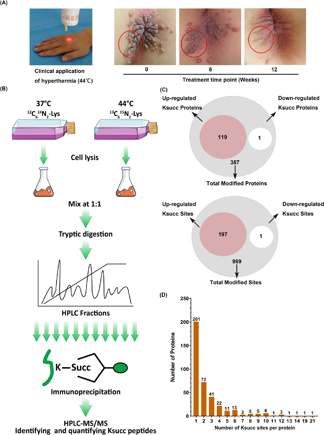 Figure 1
The clinic treatment of cutaneous warts and total profiling of lysine succinylome in HaCaT cells after response to hyperthermia. (A) Local hyperthermia treatment in children’s perianal warts. The red circle is therapeutic target for multiple verrucous lesions. (B) Experimental workflow for the identification of succinylated proteins and sites in HaCaT cells (with or without 44°C treatment). (C) Quantification of succinylated sites of HaCaT cells in response to hyperthermia. (D) Distribution of succinylation proteins based on their number of succinylated sites. Ksucc: lysine succinylation; MS/MS: mass spectrometry.
