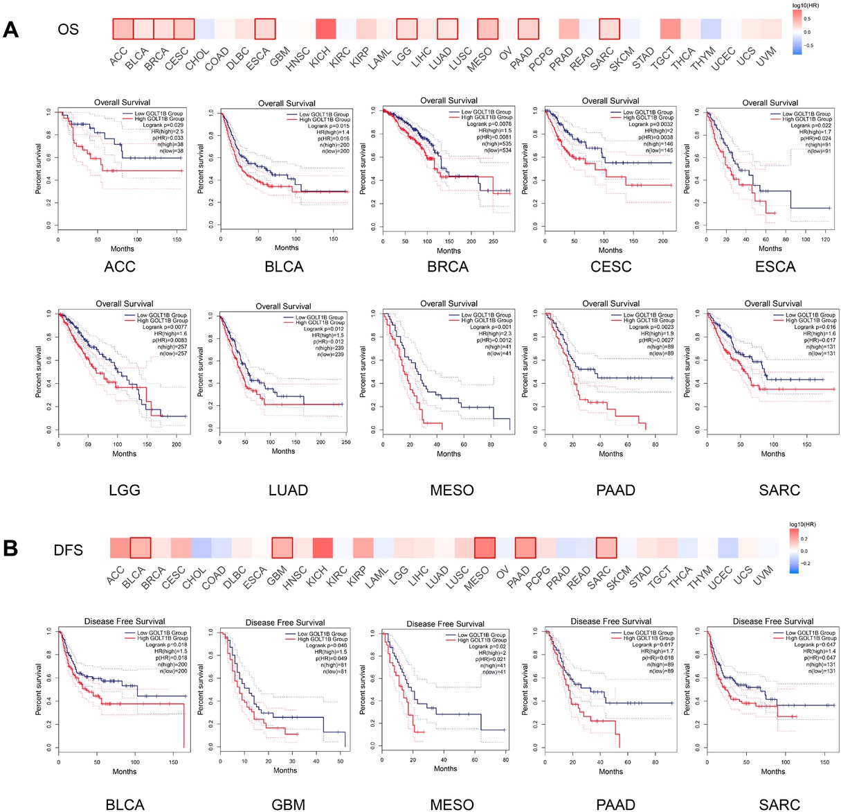 Figure 2 Prognostic significance of GOLT1B expression in many cancers. Comparison of OS (A) and DFS (B) between high and low expression of GOLT1B in different cancer types in GEPIA2. The survival map and Kaplan-Meier curves with positive results are given. OS: overall survival; DFS: disease-free survival; ACC: adrenocortical carcinoma; BLCA: bladder urothelial carcinoma; BRCA: breast invasive carcinoma, CESC: cervical squamous cell carcinoma and endocervical adenocarcinoma; CHOL: cholangiocarcinoma; COAD: colon adenocarcinoma, DLBC: lymphoid neoplasm diffuse large B-cell lymphoma; ESCA: esophageal carcinoma; GBM: glioblastoma multiforme; HNSC: head and neck squamous cell carcinoma; KICH: kidney chromophobe; KIRC: kidney renal clear cell carcinoma; KIRP: kidney renal papillary cell carcinoma; LAML: acute myeloid leukemia; LGG: brain lower grade glioma; LIHC: liver hepatocellular carcinoma; LUAD: lung adenocarcinoma; LUSC: lung squamous cell carcinoma; MESO: mesothelioma; OV: ovarian serous cystadenocarcinoma; PAAD: pancreatic adenocarcinoma; PCPG: pheochromocytoma and paraganglioma; PRAD: prostate adenocarcinoma; READ: rectum adenocarcinoma; SARC: sarcoma; SKCM: skin cutaneous melanoma; STAD: stomach adenocarcinoma; TGCT: testicular germ cell tumors; THCA: thyroid carcinoma; THYM: thymoma; UCEC: uterine corpus endometrial carcinoma; UCS: uterine carcinosarcoma; UVM: uveal melanoma.