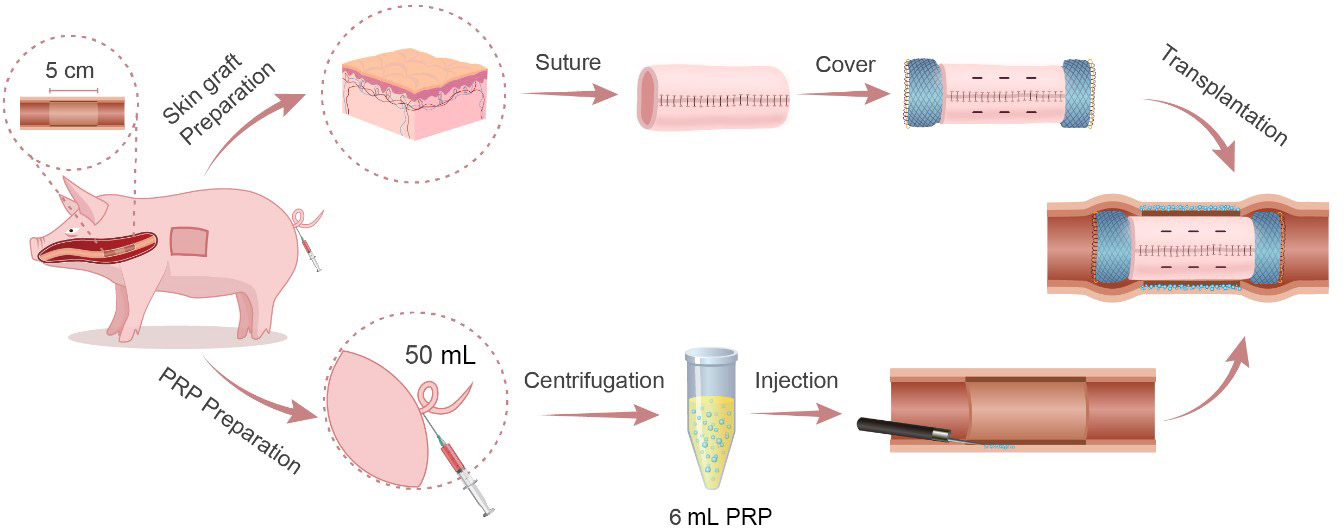 Scheme 1 
Schematic diagram of the surgical procedure.
