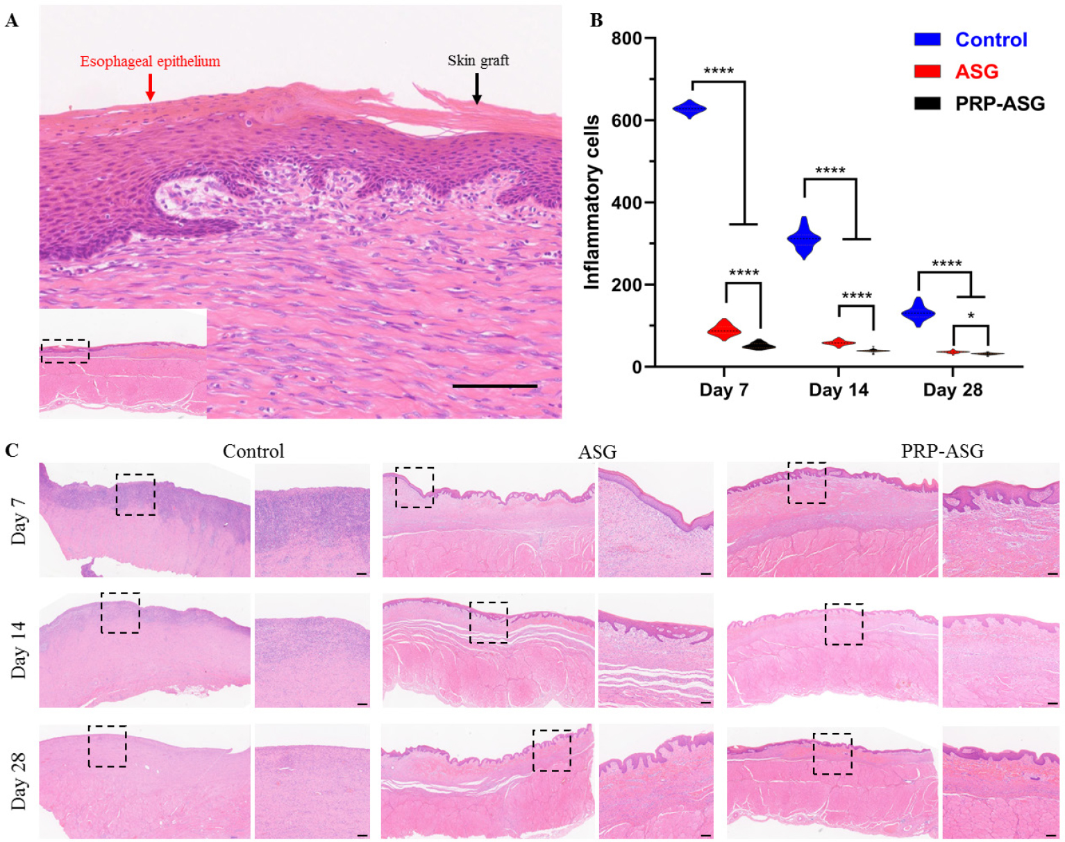 Figure 3 
Histopathological finding of the central artificial ulcer sites. (A) Magnified image of the recombinant mucosa. (B) The count of inflammatory cells. *P < 0.05, ****P < 0.0001. (C) Representative images of the central endoscopic resection sites. Scale bar = 100 μm.
