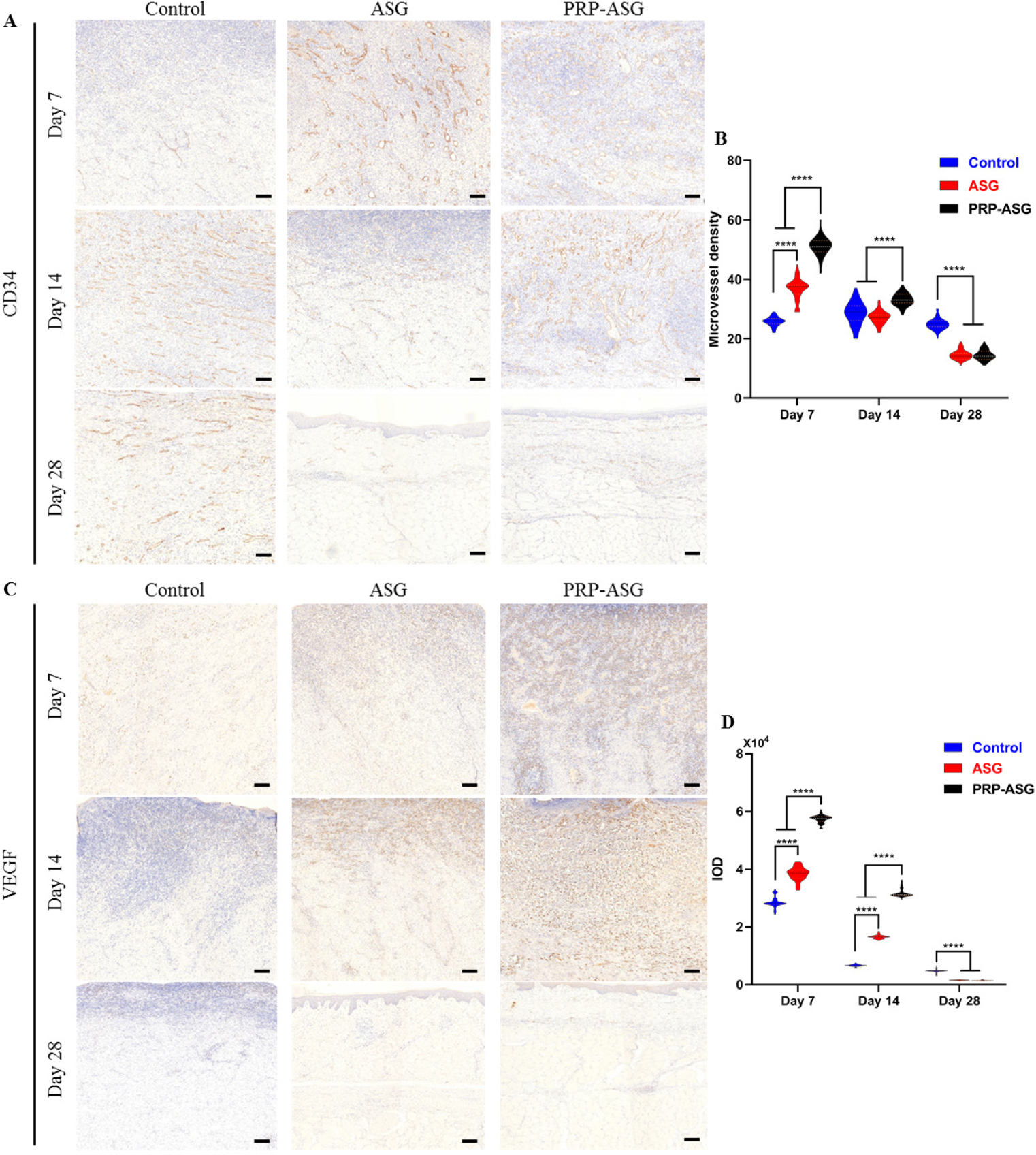 Figure 4 
Angiogenesis-related immunohistochemistry staining and histological evaluation on day 7, 14, and 28. (A) CD34-stained sections of the three groups and (B) quantification of microvessel density. (C) VEGF-stained sections of the three groups and (D) quantification of IOD. ****P < 0.0001. Scale bar = 100 μm.

