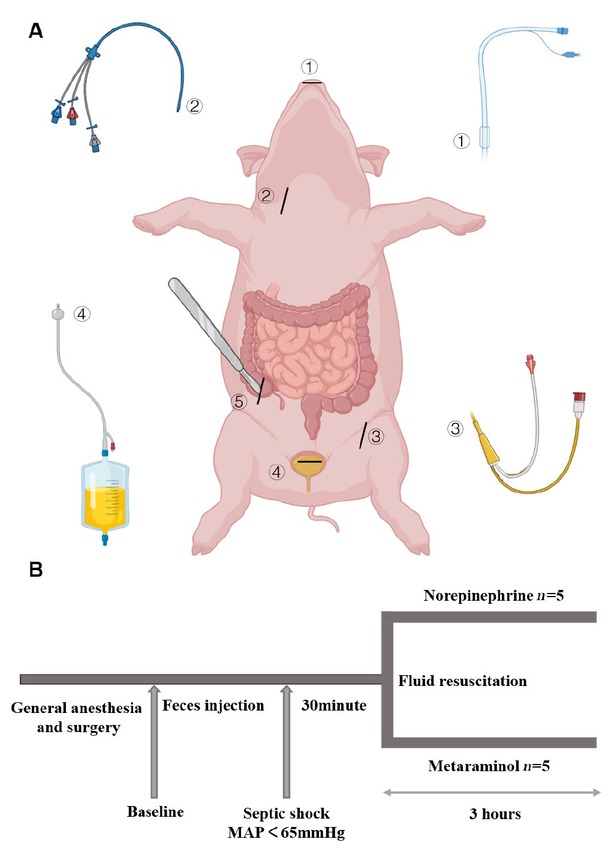 Figure 1 Arrangements for the operation (A) and protocol timeline (B). Endotracheal intubation. Triple lumen central venous catheter. PICCO. Cystostomy. Access to autologous feces from the colon where it joins ④ ⑤ ② ③ ① the cecum. At the end of the operation and after hemodynamic stabilization, baseline measurements were obtained. Blood pressure and heart rate were monitored continuously. The time point at septic shock was defined as the mean arterial pressure (MAP) < 65 mmHg. After 30 min, fluid resuscitation was started with continued infusion of norepinephrine or metaraminol as previously randomized. The last time point was 3 h after the administration of pressor drugs. PICCO: pulse-indicator continuous cardiac output.
