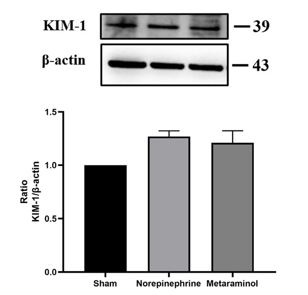 Figure 7 KIM-1 expression in kidney.