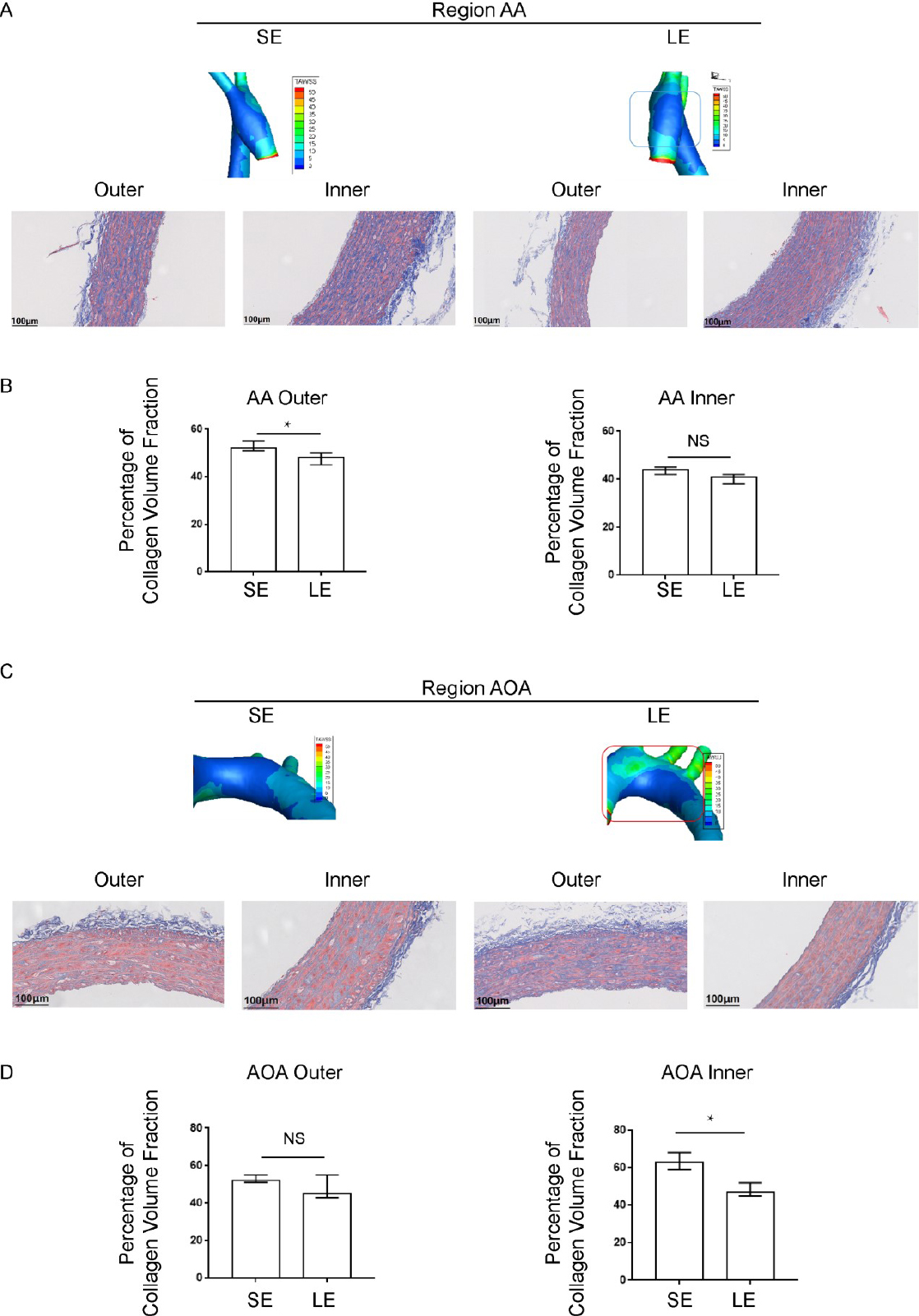 Figure 5 
Local distribution of blood flow shear stress and the collagen volume fraction in blood vessels detected by Masson staining. (A) The distribution of wall shear stress on the inner and outer walls of the ascending aorta and (B) the corresponding collagen volume fraction (C) The distribution of wall shear stress on the inner and outer walls of the aortic arch and (D) the corresponding collagen volume fraction. Data are presented as median (minimum-maximum). n = 3. The Mann-Whitney U test was used. NS, not significant. *P < 0.05. AA, ascending aorta; AOA, aortic arch; SE, sedentary; LE, long-term exercise.
