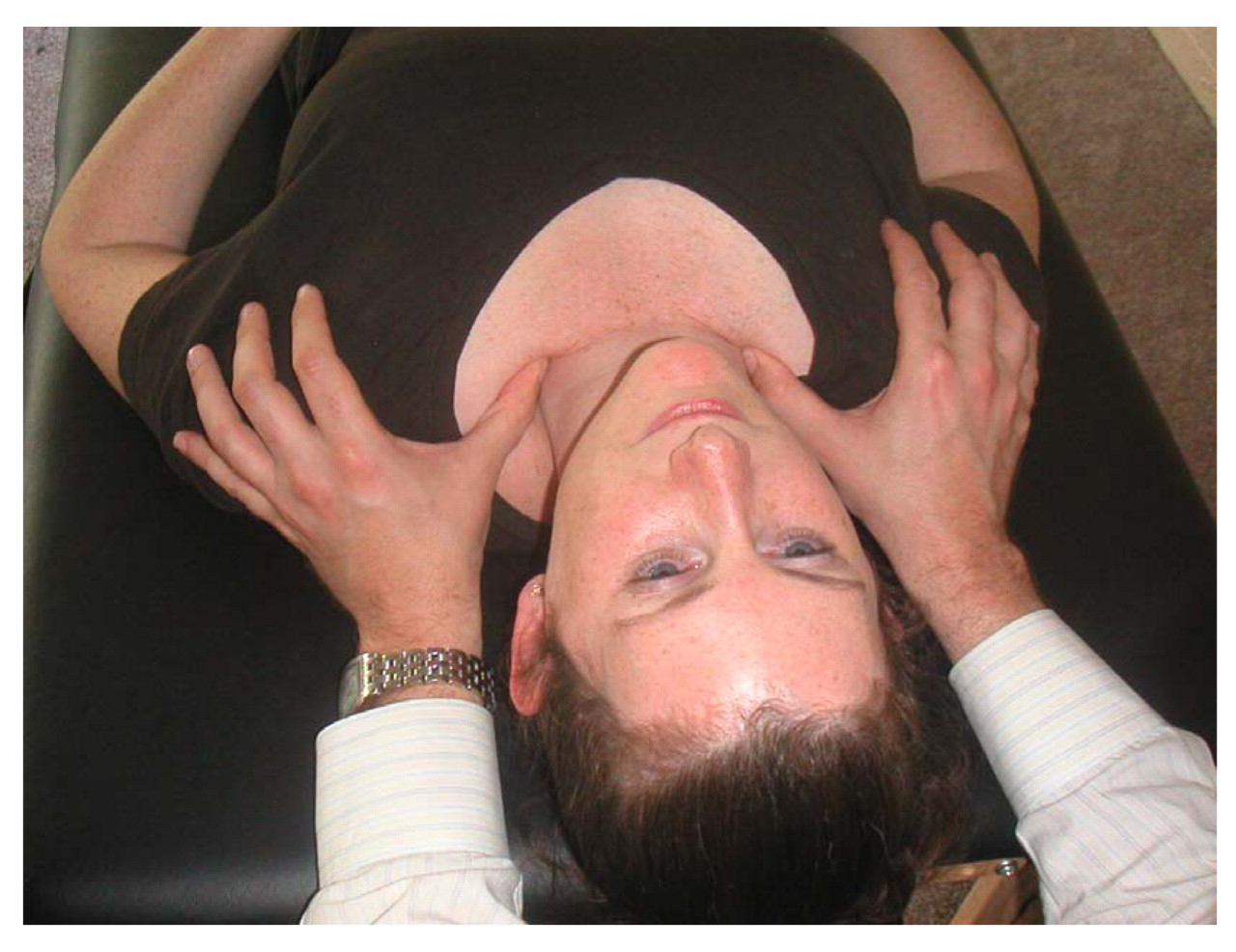 Figure 1.
To perform thoracic outlet release, the osteopathic physician's thumbs are placed in the patient's supraclavicular fossae, and pressure is applied in a caudal and lateral vector until release is felt.
