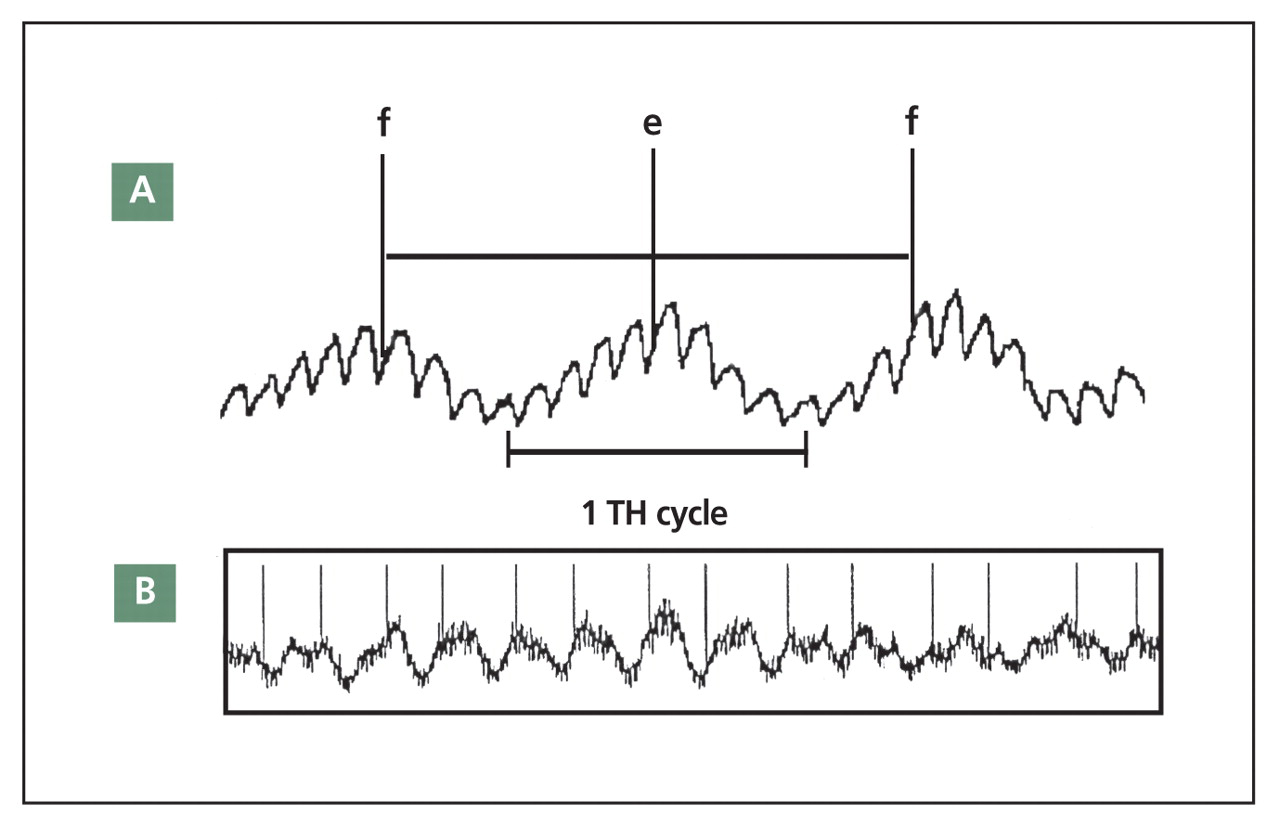 Figure 2.
Palpation of the cranial rhythmic impulse (CRI) compared with the laser Doppler flowmetry (blood flow velocity record) of the Traube-Hering oscillation (TH).
A, The CRI palpation of flexion (f) and extension (e) (vertical event marks) and the TH (oscillating trace) in a 1:2 ratio. B, Compressed flowmetry record demonstrating the 1:2 ratio. This is the most frequently encountered CRI/TH ratio demonstrated by skilled examiners.