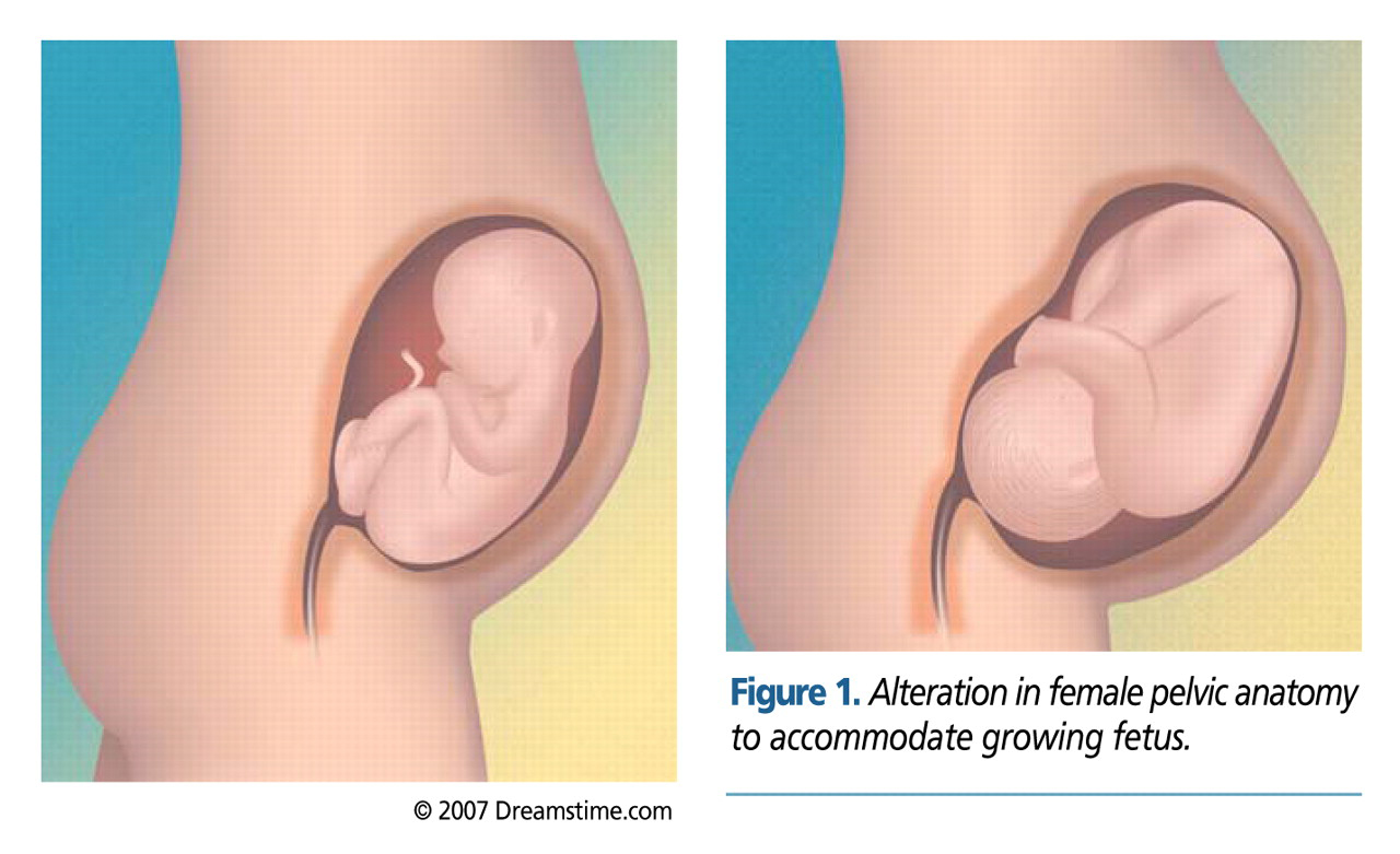 Figure 1.
Alteration in female pelvic anatomy to accommodate growing fetus.