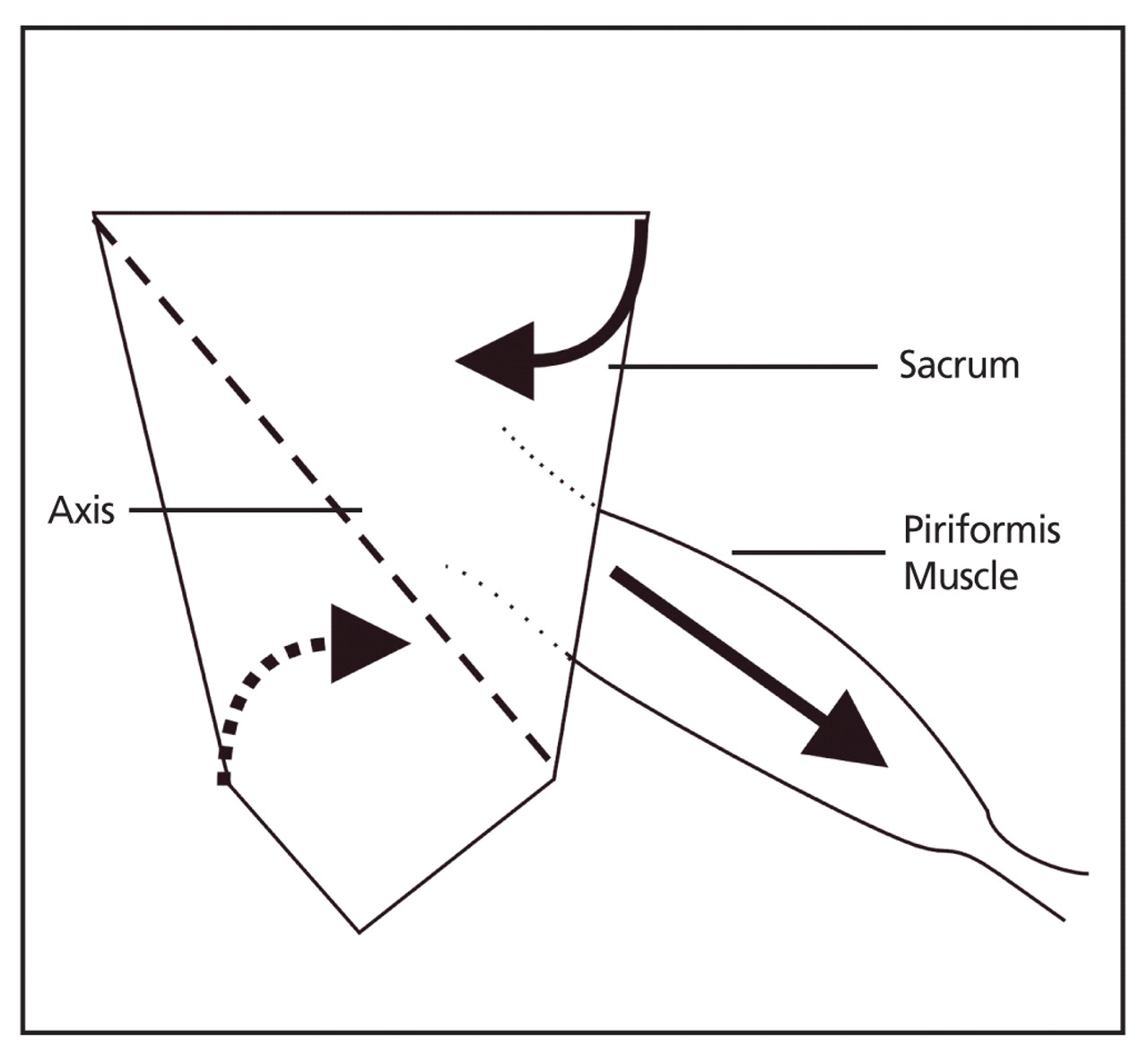 Figure 6.
The attachment of the piriformis muscle to the anterior surface of the sacrum, fixing the sacrum's oblique axis on the contralateral side and causing the sacrum to rotate to the ipsilateral side.