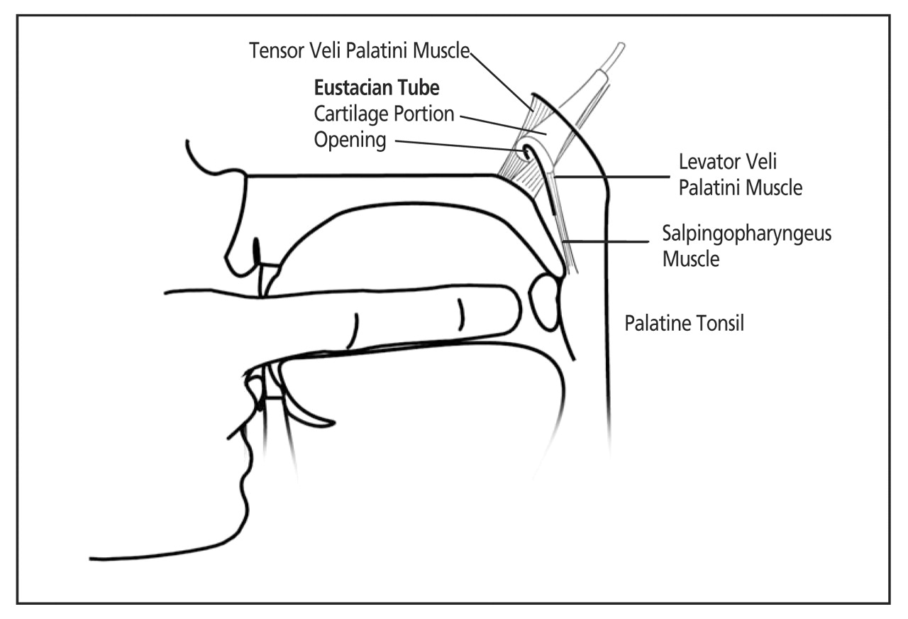 Figure 2.
In the modified Muncie technique, as described by Millicent King Channell, DO, the gloved finger should be placed over the palatine tonsil. The osteopathic physician applies a circular traction while applying a force laterally. This traction breaks adhesions of the eustachian tube, which opens superior to the tonsil and the soft palate. Printed with permission from the University of Medicine and Dentistry of New Jersey-School of Osteopathic Medicine.