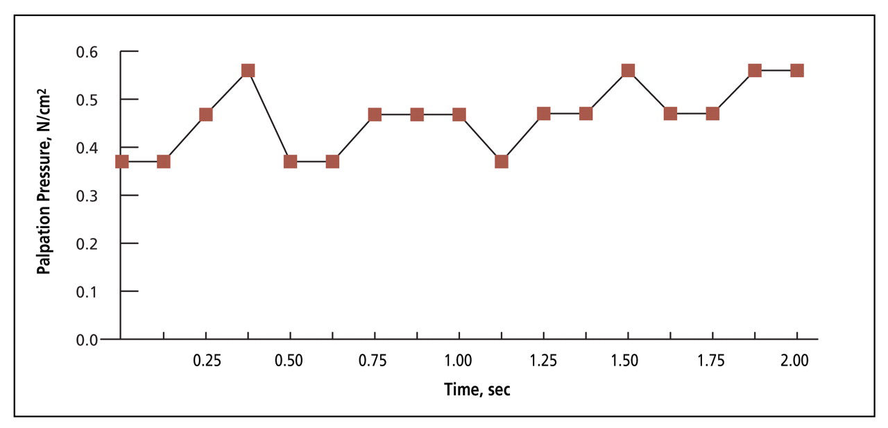 Figure 2.   
          
            Example of pressure measurements taken by FlexiForce sensor device (Tekscan Inc, South Boston, Mass) during a 2-second test. Flexi Force records the pressure measurement every 0.125 seconds, thus providing 17 pressure measurements for each test.
          
        