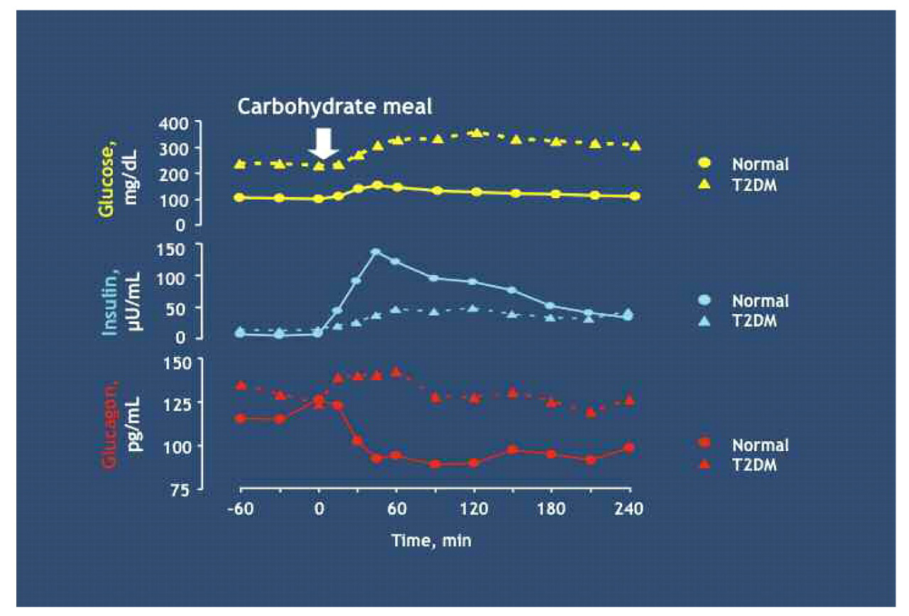Figure 2.   
          
            Plasma glucose, insulin, and glucagon profiles in response to ingestion of a carbohydrate meal in normal subjects and patients with type 2 diabetes mellitus (T2DM). Source: Müller WA et al. N Engl J Med. 1970;283(3):109-115.4Copyright 1970 Massachusetts Medical Society. All rights reserved.
        
