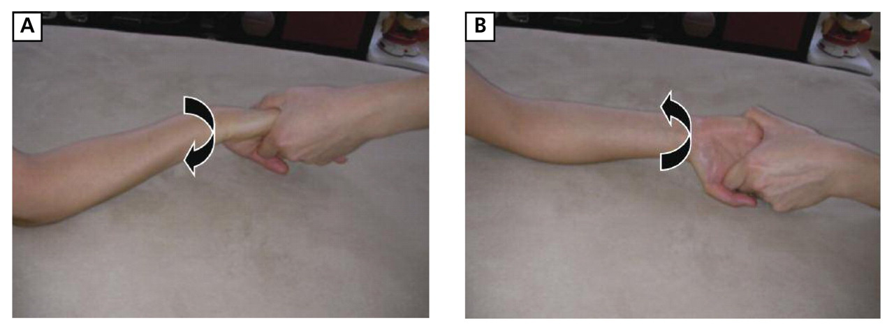 Figure 13. 
          
            Supination dysfunction and pronation dysfunction muscle energy technique. The physician holds the patient's hand in a handshake position while the palm of the free hand contacts the posterolateral aspect of the radial head to be treated. Suppination (A) and pronation (B) are applied to the patient's forearm until a restrictive barrier is reached.
          
        