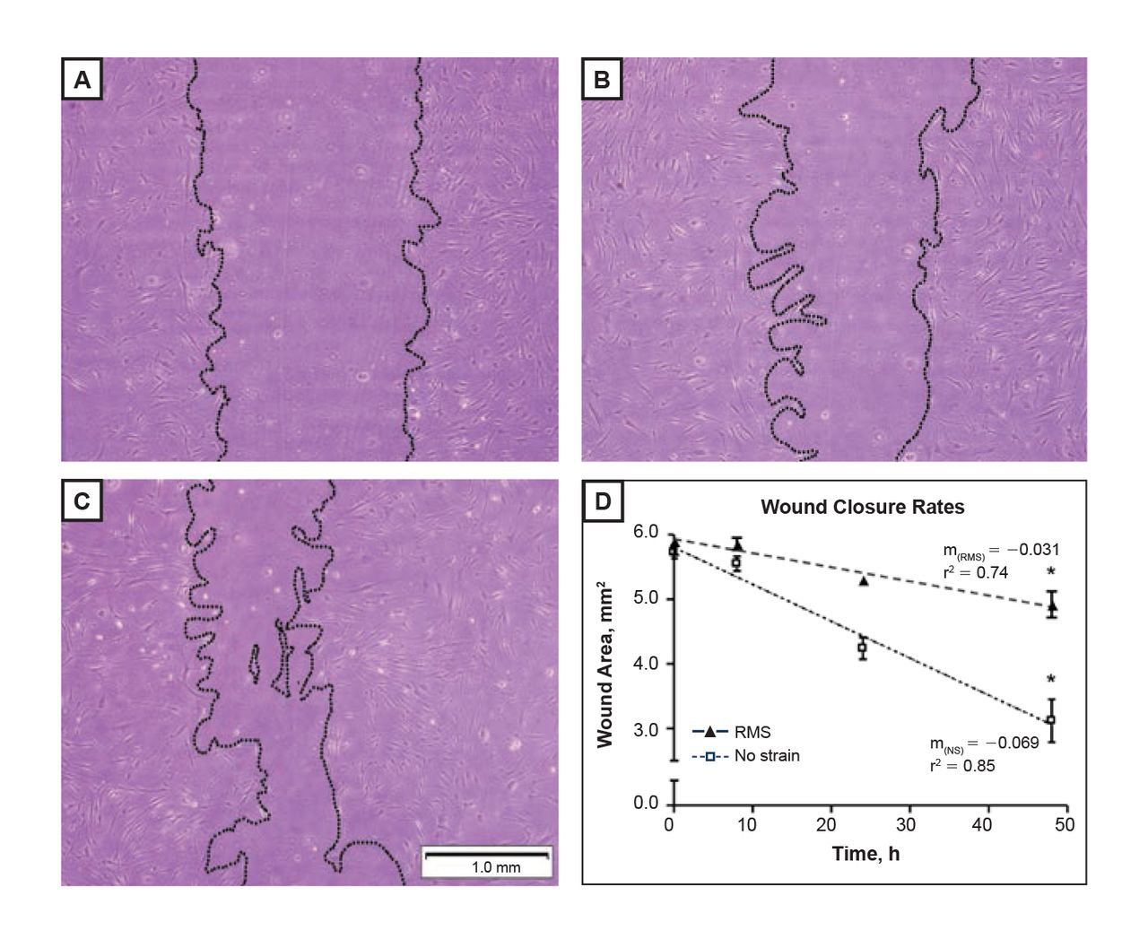 Figure 2. 
            Representative photomicrographs of nonstrain human fibroblast constructs (A) immediately (time=0), (B) 24 hours, and (C) 48 hours after wounding. (D) Changes to the wound area over a 48-hour period. Wound healing rate is equal to the absolute value of the slope (m) described by the linearly regressed line (n=5). All images were captured at magnification ×40, and the scale bar indicates 1.0 mm. Abbreviations: NS, no strain; RMS, repetitive motion strain.