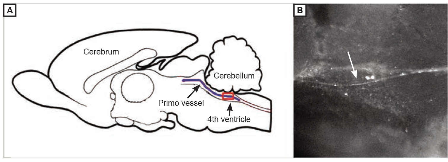 Figure 6. 
            Illustration (A) and image (B) of the primo vessel (arrows) floating inside the ventricular system of the brain.17 Reprinted with the permission of Kwang‐Sup Soh, PhD.
          