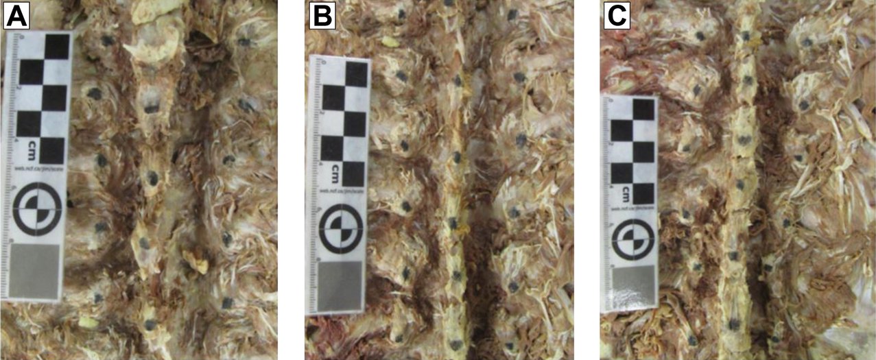 Figure 1. 
          Example photographs of the thoracic regions of a cadaver to measure the anatomic locations and relationships of the thoracic transverse and spinous processes. Each photograph was used to measure (A) T1-T4, (B) T5-T8, and (C) T9-T12. Black dots indicate the most palpable posterior portion of each process.
        